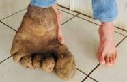 Картофель-мутант, похожий на гигантскую ногу, вырос в Бразилии 1