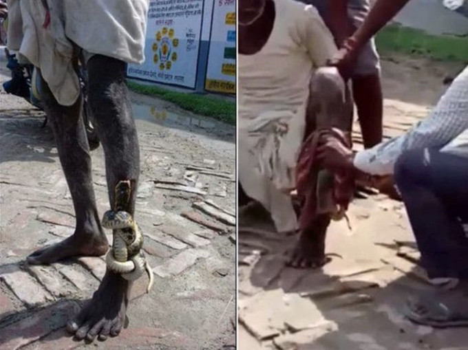 Индийский фермер прошёл 3 км до деревни со змеёй впившейся в его ногу (Видео)