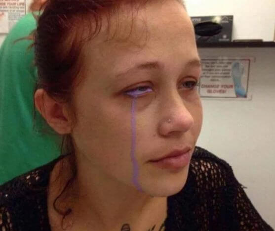 Канадская модель плачет пурпурными слезами после нанесения татуировки на глаз. (Видео)