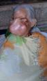 ШОК+! Гигантская опухоль обезобразила лицо пожилой филиппинки. (Видео) 4