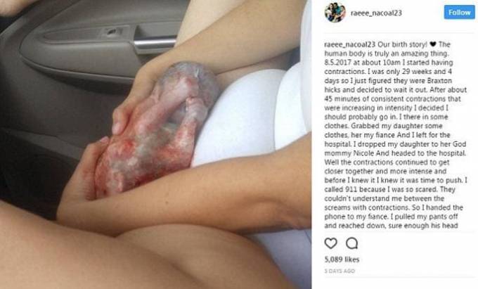 Американка, не заметившая, как родила по дороге к роддому, опубликовала первый снимок недоношенного сына.