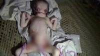ШОКИРУЮЩИЙ КОНТЕНТ !  Страшный младенец, родившийся в Индии, по мнению родителей является «Божьей волей». (Видео) 1