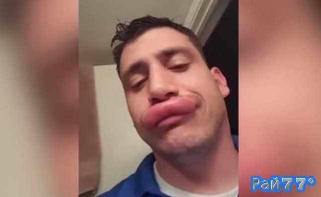 Бывший морской пехотинец с опукшей губой стал знаменитым в интернете