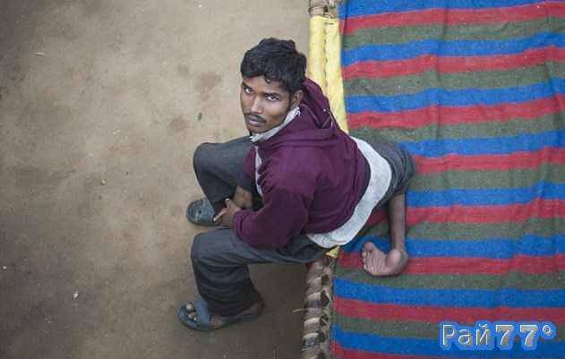 Арун Кумар (Arun Kumar), проживающий в индийском штате Уттар - Прадеш родился с четырьмя ногами.
