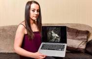 МРТ снимок младенца шокировал беременную британку 5