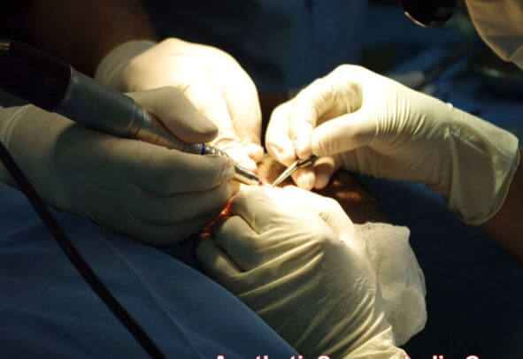 Операцию по уменьшению груди у 12-ти летнего мальчика провели в Китае.