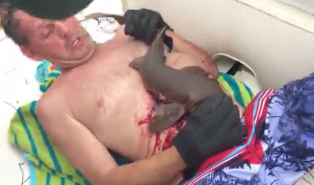 Американский пловец вернулся в лодку с вцепившейся в его тело акулой. (Видео)