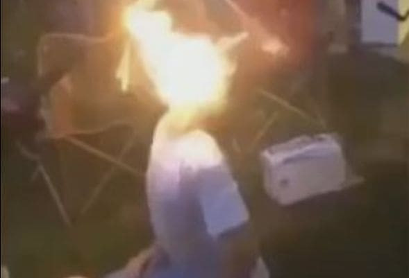 Молодой человек спалил лицо во время неудачного фокуса с фейерверком (Видео)