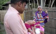 В Бангладеш попытаются разделить сросшихся головами близнецов. (Видео) 2