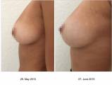 Вибрирующий бюстгальтер, увеличивающий и улучшающий форму груди, прошёл успешные испытания в США, Китае и Европе (Видео) 7
