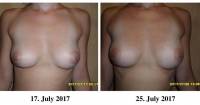 Вибрирующий бюстгальтер, увеличивающий и улучшающий форму груди, прошёл успешные испытания в США, Китае и Европе (Видео) 6